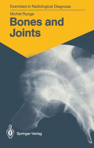 Cover of the book Bones and Joints by Peter Hertel, Peter Teller, Ulrich Weber, Hermann König