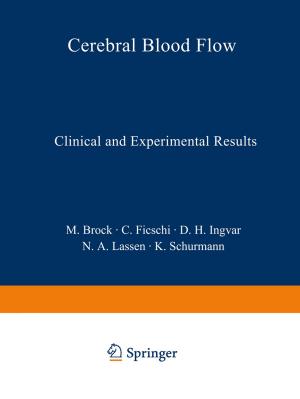bigCover of the book Cerebral Blood Flow by 