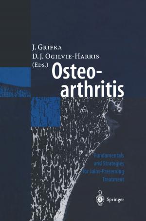 Cover of the book Osteoarthritis by Luise Lutz