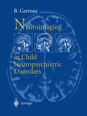 Cover of the book Neuroimaging in child neuropsychiatric disorders by 