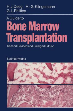 Book cover of A Guide to Bone Marrow Transplantation