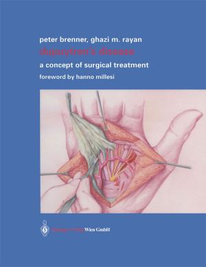 bigCover of the book Dupuytren’s Disease by 