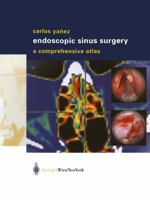 Cover of the book Endoscopic Sinus Surgery by R.W. Schlesinger, S. Hotta