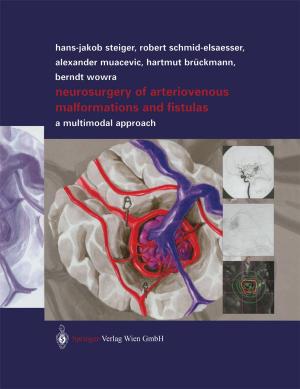 Cover of the book Neurosurgery of Arteriovenous Malformations and Fistulas by Peter Brenner, Ghazi M. Rayan