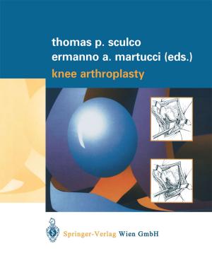 Cover of the book Knee Arthroplasty by G. Bringmann, C. Günter, M. Ochse, O. Schupp, S. Tasler