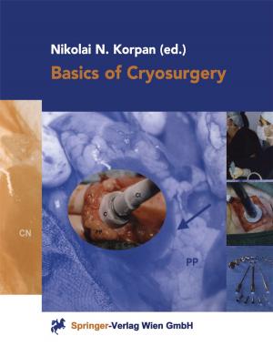 Cover of the book Basics of Cryosurgery by Eldar M. Gadzijev, Dean Ravnik