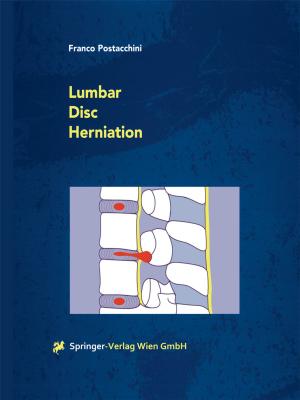Cover of the book Lumbar Disc Herniation by Brian Dondlinger, Kevin Hoag