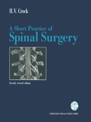 bigCover of the book A Short Practice of Spinal Surgery by 