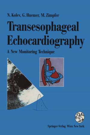 Cover of the book Transesophageal Echocardiography by J.M. Gilsbach