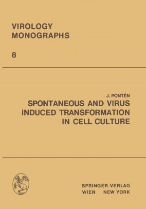 Cover of the book Spontaneous and Virus Induced Transformation in Cell Culture by 