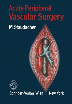 Cover of the book Acute Peripheral Vascular Surgery by H. Krayenbühl, J. Brihaye, F. Loew, V. Logue, S. Mingrino, B. Pertuiset, L. Symon, H. Troupp, M. G. Ya?argil
