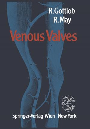 Cover of the book Venous Valves by P. Harris, R. Firsching, R.A. Frowein, G. Foroglou, G. Friedmann, R.A. Frowein, J.W. Glowacki, P. Guillermain, N. Nakamura, I. Oprescu, P. Rabehanta, K.E. Richard, D.A. Stalhammar, U. Stammler, F. Thun, R.P. Vigouroux