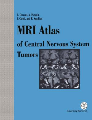 Cover of the book MRI Atlas of Central Nervous System Tumors by Bernard George, Claude Laurian