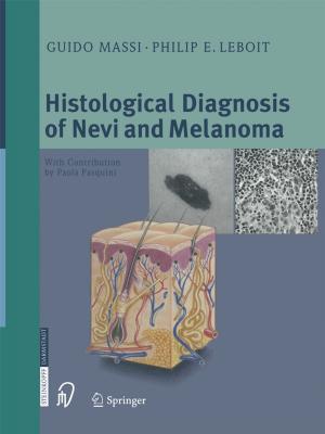 Cover of the book Histological Diagnosis of Nevi and Melanoma by N. Gschwend, J. Winer, A. Böni, W. Busse, R. Dybowski, J. Zippel