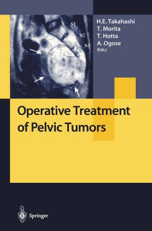 Cover of the book Operative Treatment of Pelvic Tumors by Yuki Harada