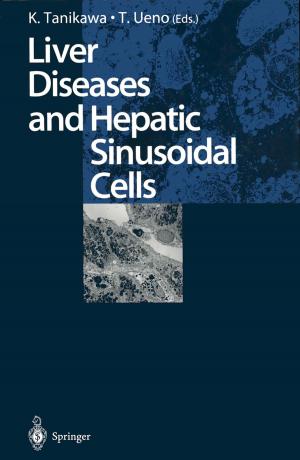 Cover of the book Liver Diseases and Hepatic Sinusoidal Cells by Yozo Fujino, Kichiro Kimura, Hiroshi Tanaka