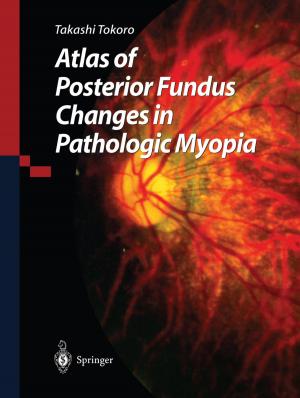 Cover of the book Atlas of Posterior Fundus Changes in Pathologic Myopia by Richard Doviak, Kyosuke Hamazu, Shoichiro Fukao