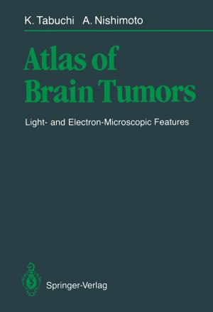 Cover of the book Atlas of Brain Tumors by Akihiko Hirata, Kaname Matsue, Mingwei Chen