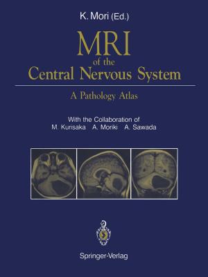 Cover of the book MRI of the Central Nervous System by Takanori Sugiyama