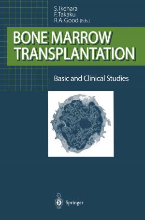 Cover of the book Bone Marrow Transplantation by Masanori Hamada