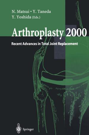 Cover of the book Arthroplasty 2000 by Naoyuki Fuse, Tasuku Kitamura, Takashi Haramura, Kentaro Arikawa, Michio Imafuku