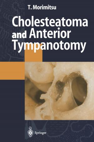 Cover of the book Cholesteatoma and Anterior Tympanotomy by Teruo Matsushita