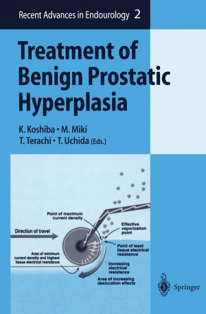 Cover of the book Treatment of Benign Prostatic Hyperplasia by Masanori Hamada