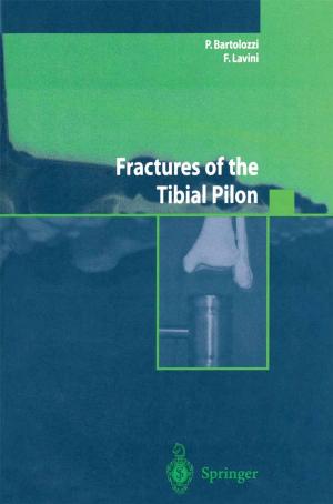 Cover of the book Fractures of the Tibial Pilon by Maurizio De Luca, Giampaolo Formisano, Antonella Santonicola