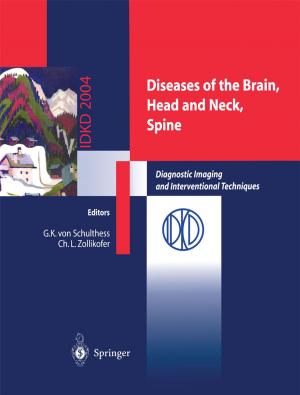 Cover of the book Diseases of the Brain, Head and Neck, Spine by Giulio Sapelli