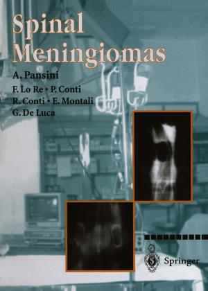 Cover of the book Spinal Meningiomas by Marco Rengo, Carlo Nicola De Cecco