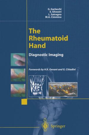 Cover of the book The Rheumatoid Hand by 