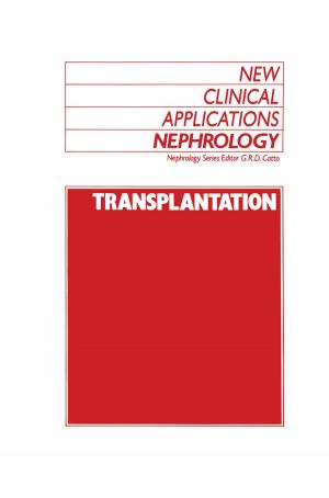 Cover of the book Transplantation by J.C. Boudri