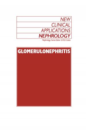Cover of the book Glomerulonephritis by Anton G. Kutikhin, Arseniy E. Yuzhalin, Elena B. Brusina