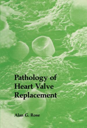 Book cover of Pathology of Heart Valve Replacement