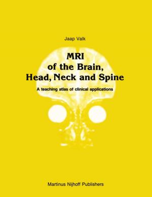 Cover of the book MRI of the Brain, Head, Neck and Spine by R. Kenneth Horst