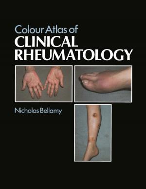 Cover of the book Colour Atlas of Clinical Rheumatology by D.F. Horrobin
