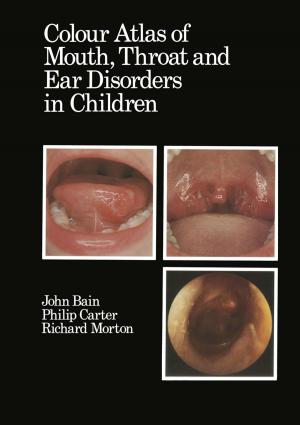 Cover of the book Colour Atlas of Mouth, Throat and Ear Disorders in Children by 