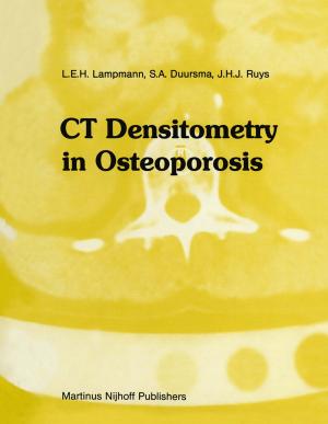 Cover of the book CT Densitometry in Osteoporosis by Robert Lyndon