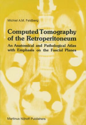 Book cover of Computed Tomography of the Retroperitoneum