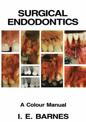 Cover of the book Surgical Endodontics by R. M. Harrison