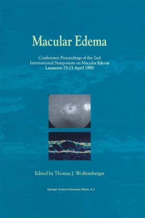 Cover of the book Macular Edema by Frank P. Morello, Paul K.T. Sih