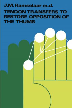 Cover of the book Tendon Transfers to Restore Opposition of the Thumb by 