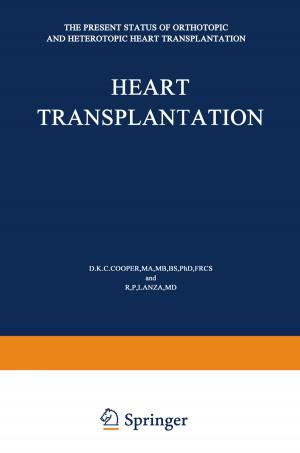 Cover of the book Heart Transplantation by Domen Novak, Samo Beguš, Matjaž Mihelj