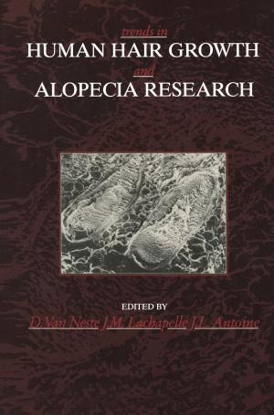 Cover of the book Trends in Human Hair Growth and Alopecia Research by R.F. de Brabander