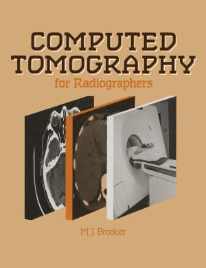 Book cover of Computed Tomography for Radiographers