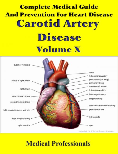 Cover of the book Complete Medical Guide and Prevention for Heart Diseases Volume X; Carotid Artery Disease by Medical Professionals, MedHealth