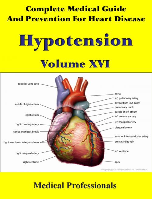 Cover of the book A Complete Medical Guide and Prevention For Heart Diseases Volume XVI; Hypotension by Medical Professionals, MedHealth