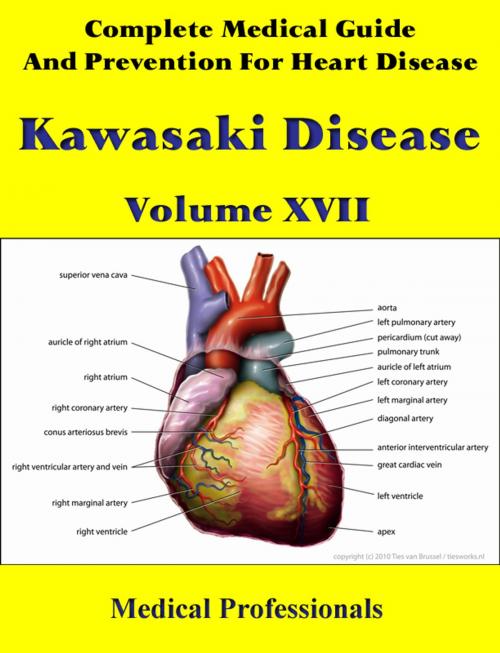 Cover of the book A Complete Medical Guide and Prevention For Heart Diseases Volume XVII; Kawasaki Disease by Medical Professionals, MedHealth