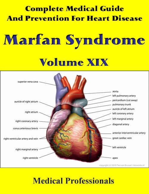 Cover of the book A Complete Medical Guide and Prevention For Heart Diseases Volume XIX; Marfan Syndrome by Medical Professionals, MedHealth