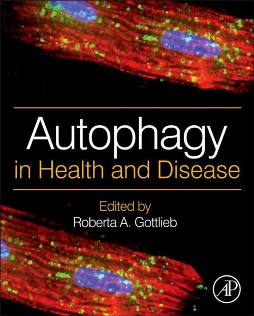 Cover of the book Autophagy in Health and Disease by , Elsevier Science